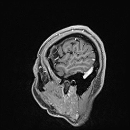 Click on the Serie image to view the images of VILLANUEVA, WILLIAM A.